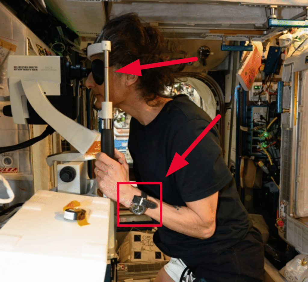 A Disturbing Visual Issue Affects 70% of Astronauts During Extended Spaceflights 2 NASA astronaut Suni Williams wears a cuff on her left leg as she conducts an eye exam. (NASA)
